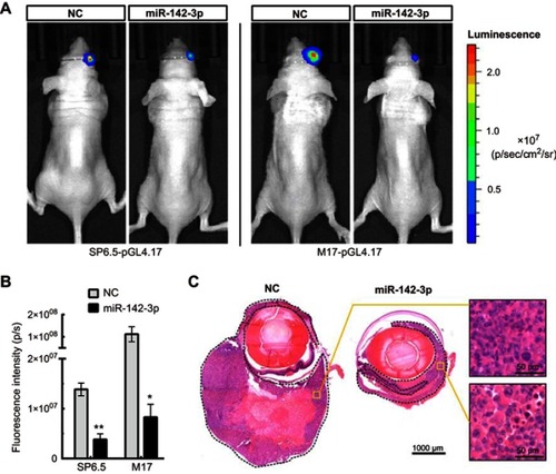 Figure 5 Overexpression of miR-142-3p suppresses tumor growth in vivo. (A) In vivo biofluorescence imaging of nude mice following suprachoroidal injection of UM cells transfected with miR-142-3p or NC. (B) The quantitative data for the in vivo biofluorescence imaging assay (n=5/group). (C) Representative image of hematoxylin-eosin staining of eyeball sections from nude mice. The tumor tissues (formed by SP6.5-pGL4.17 cells) have been enclosed by a dashed line. *P<0.05, **P<0.01.