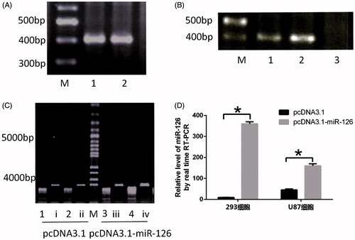 Figure 2. Construction of miRNA-126 expression vector. (A) Amplification of target fragment. M, DNA ladder; 1 and 2, miR-126 precursor; (B) M, DNA ladder; 1 and 2, there are target fragments at ∼400 bp, indicating that the fragment had been inserted into expression vector pcDNA3.1; 3, the fragment had not been inserted into expression vector pcDNA3.1; (C) double digestion results, M, 100 bp plus DNA ladder; i–iv, undigested control plasmids, 1–4, digested plasmids; (D) verification of miR-126 expressions. *P < .05.