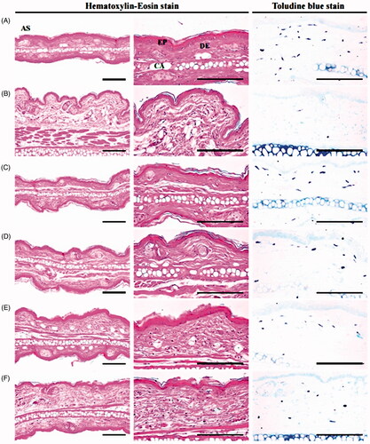 Figure 9. Representative histological images of lung in antitussive assay. (A) Intact vehicle control: Vehicle (distilled water) treated intact control mice. (B) NH4OH control: Vehicle administered and NH4OH exposed control mice. (C) TB: TB 50 mg/kg administered and NH4OH exposed mice. (D) KOG100: KOG 100 mg/kg administered and NH4OH exposed mice. (E) KOG200: KOG 200 mg/kg administered and NH4OH exposed mice. (F) KOG400: KOG 400 mg/kg administered and NH4OH exposed mice. NH4OH: Ammonia hydroxide. KOG: Kyeongok-go, Traditional mixed herbal formulation; TB: Theobromine; ASA: Alveolar surface area; SB: Secondary bronchus; BR: Bronchus; TA: Alveolus-terminal bronchiole. All Haematoxylin-Eosin stain. Scale bars: 120 µm.