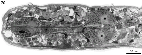 Fig. 70. Robbea hypermnestra sp. nov. Semi-thin longitudinal section through pharynx showing separation of corpus from isthmus and glandular bulbus.