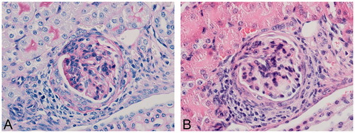 Figure 3. Glomerulonephritis in BSA-dosed mouse. (A) Glomerular basement membrane thickening (PAS) and (B) increased cellularity in a C57BL/6J mouse dosed with 10 mg/kg BSA SC for 13 weeks in dose-finding study. Original objective 60×.