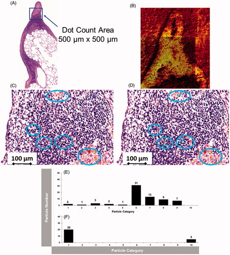 Figure 4. (A): Histopathological lung tissue section from the 2-year inhalation study (3.0 mg/m3). The blue square indicates the area, where ToF-SIMS was applied (B). CeO2 NP agglomerates were correlated with histopathological light microscope image (C). (D): Overlay picture (500 µm × 500 µm) of ToF-SIMS signal for CeO2 NP (blue) with histopathological image (b). CeO2 NPs are associated with the BALT (bronchusassociated lymphoid tissue). (E,F): Counts of CeO + agglomerate signals from six image sections (1.5 mm × 1 mm, 6144 pixel × 4096 pixel) from three different lung slices (two each from one lung slice, a total of 36 pictures were counted for (E) and (F) each) at 24-month time point (E) 1.0 mg/m3 and (F) 3.0 mg/m3). The CeO2 NP agglomerates were categorized into 10 groups. Group #1: 1–1.4 µm2; Group #2: 1.5–2.4 µm2; Group #3: 2.5–3.5 µm2; Group #4: 3.5–4.5 µm2; Group #5: 4.5–6.1 µm2; Group #6: 6.1–12.17 µm2; Group #7: 12.17–16.38 µm2; Group #8: 16.38–30.42 µm2; Group #9: 30.42–200 µm2; Group 10: >200 µm2 particle area.