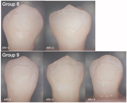 Figure 5. Stereomicroscope pictures right after bracket debonding. Adhesive remnant index (ARI) 0 = no adhesive on the tooth, 1 = less than ½ adhesive on the tooth, 2 = more than ½ of the adhesive on the tooth, 3 = all of the adhesive on the tooth, 4 = enamel fracture.