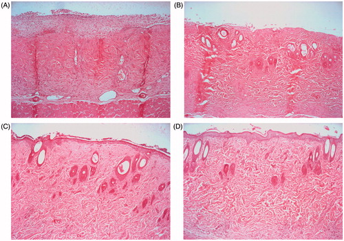 Figure 5. Representative histopathological profiles: (A) nontreated; (B) commercial product-treated; (C) drug-free HD treated; (D) neomycin sulfate-loaded HD treated.