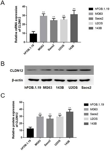 Figure 1 The mRNA and protein expression levels of CLDN12 in human fetal-osteoblast line and osteosarcoma cell lines was explored via RT-PCR and Western blot. (A) The relative mRNA expression of CLDN12 in fetal-osteoblast line and osteosarcoma cell lines. (B) The relative protein expression of CLDN12 in fetal-osteoblast line and osteosarcoma cell lines. (C) The corresponding statistical analysis of CLDN12 protein expression. **P<0.01, compared with the fetal-osteoblast line.Abbreviation: CLDN12, claudin-12.