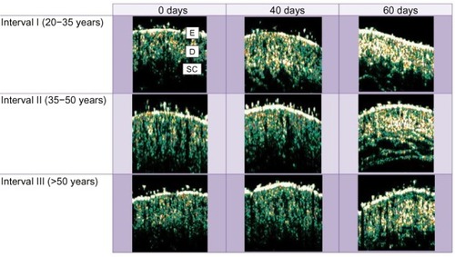 Figure 2 The variation of age-dependent ultrasonic key markers at days 0, 40, and 60 of vitamin C-based therapy. A significant increase in the hyperechoic pixels is noticed in all age intervals throughout and after topical vitamin C therapy.