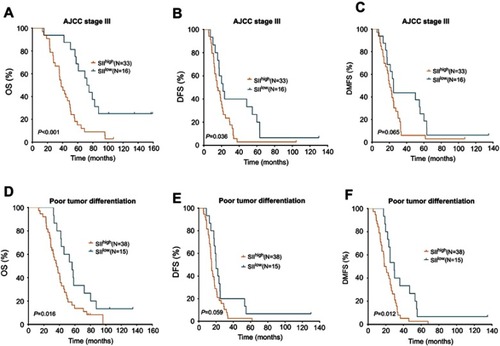Figure 2 Kaplan-Meier curves for patients with AJCC stage III and poor tumor differentiation. In patients with AJCC stage III, OS (A), DFS (B), and DMFS (C) as derived by the SII. In patients with poor tumor differentiation, OS (D), DFS (E), and DMFS (F) as derived by the SII.Abbreviations: AJCC, American Joint Committee on Cancer; OS, overall survival; DFS, disease-free survival; DMFS, distant metastasis-free survival.