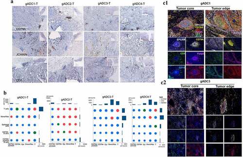 Figure 6. Localization of immune cells in tertiary lymphatic structures between malignant and nonmalignant tissues in gastric adenocarcinoma (gADC) patients
