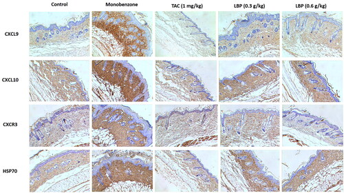 Figure 3. Effects of LBP on the Hsp70-CXCL9/CXCL10 signalling pathway in mice with monobenzone-induced vitiligo. Representative immunochemical photograph of CXCL9, CXCL10, CXCR3 and HSP70 in skin. The depth of brown granules represents the expression of CXCL9, CXCL10, CXCR3 and HSP70, respectively (magnification × 200, scale bar = 50 μm).