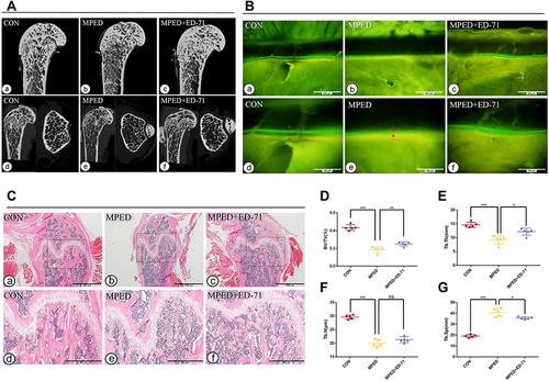 Figure 1 Effects of ED-71 on bone quantity and quality in MPED-induced osteoporosis mice. (A). a–f The representative 2D and 3D Micro-CT images of femur in CON, MPED and MPED+ED-71 groups at 4 weeks. (B). a–f Calcein and tetracycline labeling of mice femur at 4 weeks. The red arrow indicates the distance between calcein and tetracycline fluorescence labeling. Bar, 200μm or 100μm. (C). a–f The HE staining of mice femur. Bar, 1mm or 500μm. (D–G). Statistical analysis of bone histological parameters. Error bars stand for mean ± SD (n=5). *P < 0.05. **P < 0.01.***P < 0.001.