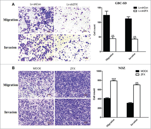 Figure 5. Effect of ZFX on the invasion and migration potential of GBC cells in vitro. (A) Representative photos of crystal violet-stained GBC-SD and NOZ cells that migrated through polycarbonate membranes. (B) Representative photos of crystal violet-stained GBC-SD and NOZ cells that invaded through matrigel-coated membrane. The number of GBC-SD and NOZ cells that migrated through the membranes was calculated and depicted in the bar chart. graph shows mean ± SD. Significant differences from the control are indicated by **P < 0.01 and ***p < 0.001)