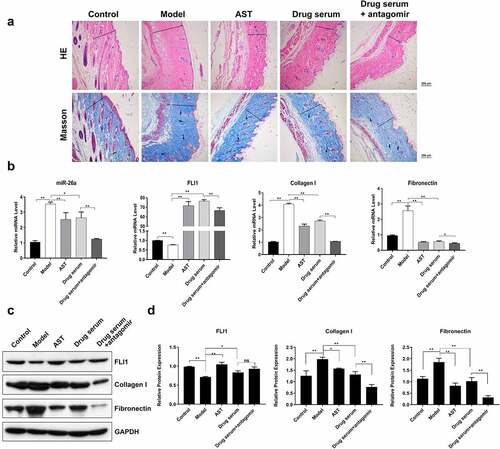 Figure 5. Enhanced anti-fibrosis effect of BSYJ by miR-26A suppression