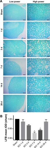 Figure 3 Myelination of the spinal cord after SCI investigated through staining of LFB.