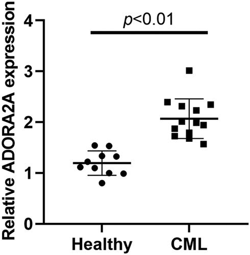 Figure 1. The expression of ADORA2A-AS1 is upregulated in CML. The expression of ADORA2A-AS1 in CML patients (n = 13) and healthy individuals (n = 10) by qRT-PCR.