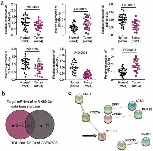 Figure 1. LINC00115/miR-489-3p/PFKFB2 axis in RB. (a) qRT-PCR was used to detect the expression of miR-146a-5p, miR-146b-5p, miR-615-3p, miR-7153-5p, miR-489-3p and miR-212-5p in RB tissues (N = 24) and normal tissues (N = 24). (b) The common/overlapping genes between the target list of miR-489-3p predicted by starbase algorithm and the DEGs in RB from GSE97508. DEGs: differentially expressed genes; DEGs were selected according to adjusted P < 0.05 and logFC≥1.5. (c) The PPI network analysis of the overlapping genes. According to string database, the interaction edges in the PPI network represent the interaction evidence strength. Data are presented as mean ± SD.