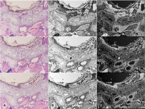 Figure 3. Image editing steps prior to rendering. (a) Light microscopic sectioned images with basic H&E staining. (b) Images converted into grayscale mode due to sensitivity of the program. (c) Unwanted portions may be trimmed to increase accuracy. (d) Color inversion completed in order to eliminate background in the rendering program.