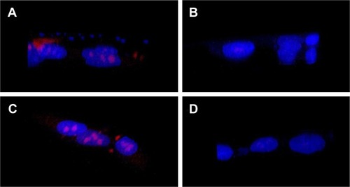Figure 3 Cellular internalization by Z-stack imaging.Note: Z-stack images of (A, B) DOX-loaded targeted and bare MSNPs in MCF-7 cells, respectively, and (C, D) DOX-loaded targeted and bare MSNPs in LNCaP cells, respectively.Abbreviations: DOX, doxorubicin; MSNPs, mesoporous silica nanoparticles.