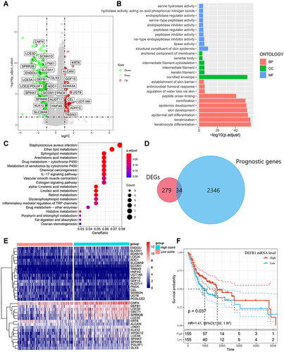 Figure 4 Identification of differentially expressed genes (DEGs) that related with CD4+ central memory T cell and functional enrichment analysis. (A) The volcano plot of DEGs between oral squamous cell carcinoma (OSCC) groups with high and low CD4+ central memory T cell abundance. (B)Gene Ontology (GO) enrichment analysis of DEGs related with CD4+ central memory T cell. MF, molecular function; CC, cell component; BP, biological process. (C) Enriched Kyoto Encyclopedia of Genes and Genomes (KEGG) pathways of DEGs related with CD4+ central memory T cell. (D) Venn diagram of the overlapped genes between DEGs related with CD4+ central memory T cell and prognostic genes in OSCC patients. (E) Cluster analysis for prognostic DEGs related with CD4+ central memory T cell OSCC patients from the TCGA cohort. (F) The survival rate of OSCC patients in the TCGA cohort with high and low DEFB1 expression.