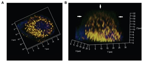 Figure 10 Confocal three dimensional images of Nile red-labeled and NBD-labeled liquid crystalline nanoparticles in Caco-2 cells at 90 minutes. (A) Top view and (B) side view. Red, Nile red; green, NBD-PE; blue, cell nuclei stained with Hoechst.Note: Arrow, NBD-PE separated from liquid crystalline nanoparticles and inserted into the cell membrane.Abbreviation: NBD-PE, N-(7-nitrobenz-2-oxa-1, 3-diazol-4-yl)-1, 2-dihexadecanoyl-sn-glycero-3-phosphoethanolamine.