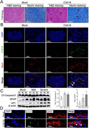 Figure 3. CVA19 directly infects brain neurons and induces neurological pathological damage. H&E staining and Nissl staining (A) were used to evaluate the pathological changes of brains in severe infected mice. The black arrows indicated typical pathological changes. (B) Fluorescence signals representing viral RNA in the neurons (cerebral cortex) were indicated by white arrows utilizing IF and FISH testing. WB analysis (C) was used to detect the expressions of cleaved-Caspase3 and GFAP in brains (n = 3 per group). The representing VP1 band was the agarose gel electrophoresis image (917 bp, primer sequence: Forward, GACACACAGTCTAGCGGACC; Reverse, TTGACGGCCTTCTCCATGTC). The protein expression level was expressed as mean ± SD. (D) Fluorescence signals representing viral RNA in the astrocytes (hippocampus) were indicated by white arrows utilizing IF and FISH testing. The variance analysis was conducted by two-tailed Student’s t-test on performing the comparison of two groups. Mild or severe group vs mock, * P < 0.05.