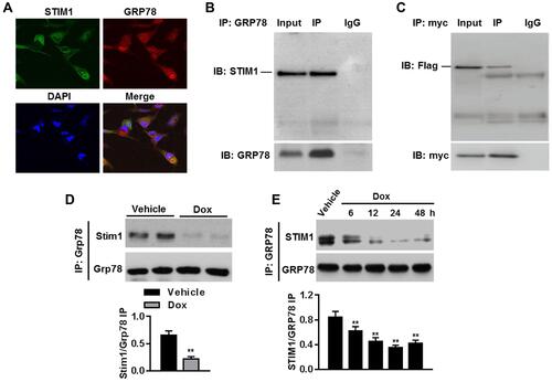 Figure 7 STIM1 relieves ER stress by binding to GRP78 in cardiomyocytes. (A) Representative images of STIM1 and GRP78 distribution in cardiomyocytes. (B) Cell lysates were immunoprecipitated with anti-GRP78 antibody and immunoprecipitated (IP) proteins were immunoblotted (IB) with anti-STIM1 antibody. n=5. (C) Cardiomyocytes were co-transfected with STIM1-flag plasmid and GRP78-myc plasmid. Anti-myc antibody was immunoprecipitated and immunoblotted with anti-flag antibody. n=4. (D) Immunoblotting for Stim1 after immunoprecipitation with anti-Grp78 antibody in myocardium from vehicle- or Dox-treated mice. **P<0.01 vs vehicle, n=6/group. (E) Cardiomyocytes were treated with Dox (1 μmol/L) for different times as indicated. Immunoprecipitation analysis was performed to determine the interaction between STIM1 and GRP78. **P<0.01 vs vehicle, n=4.