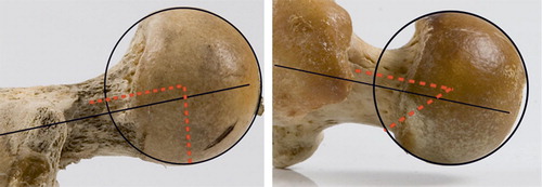 Figure 16. Beta angles in a monkey coxa recta (80°, mandrill, left) and an ape coxa rotunda (42°, chimpanzee, right). Also note differences in anterior and posterior head-neck offset and neck version between coxa recta and coxa rotunda. Mandrill has 10° anteversion, chimpanzee has 12° retroversion. View is perpendicular to the femoral neck, anterior is up, posterior is down.