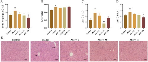 Figure 1. AS-IV improved liver function and alleviated liver injury in mice with acute alcohol-induced liver injury (n = 5–10). (A) Body weight gain. (B) Liver index. (C) Serum levels of ALT. (D) Serum levels of AST. (E) H&E staining of liver tissue samples (magnification, 200×, the arrows indicate cell degeneration, hepatocyte necrosis, and nuclear necrosis). The data are represented as means ± SEM. #p < 0.05 vs. control group, *p < 0.05 and **p < 0.01 vs. model group. ns - no significance.