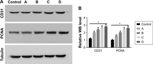 Figure 10 Western blot to detect PCNA and CD31 expression.Notes: (A) The protein levels of PCNA and CD31 in the full-thickness wound tissues, as determined by Western blot. (B) The OD values of the PCNA and CD31 bands in each grouP> *Represents P<0.05. Group A (chitin), group B (chitin + amphiphilic ion), group C (chitin + quaternary ammonium salt), and group D (chitin + amphiphilic ion + quaternary ammonium salt).Abbreviations: PCNA, proliferating cell nuclear antigen; WB, Western blot.