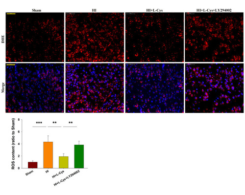 Figure 5 L-Cysteine suppresses HI-induced increases in ROS content through the Akt pathway. Representative photographs of DHE staining in the right cortex at 72 h post-HI. Quantification of ROS content in each group (Scale bar = 50 μm; N=4/group). Six randomly selected images (× 20) were captured from each section. Values represent the mean ± SD, **p < 0.01, ***p < 0.001according to ANOVA.