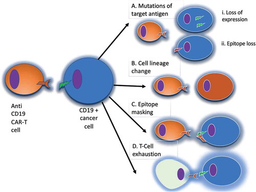 Figure 4. Mechanisms of evasion from anti-CD19 CAR-T cells. Panel A: in the case of loss of the target antigen, two different mechanisms have been described: i) internalization of the surface antigen (e.g. CD19); ii) amino-acidic modification of the CAR binding site. Panel B: in the case of cell lineage change, tumor cells can switch their phenotype to a different lineage, that constitutively does not express CD19. Panel C: epitope masking occurs when during lentiviral transfection a single leukemic or lymphoma cell is modified to express the CAR. Panel D: T-cell exhaustion may occur when the CAR-T cell population is chronically stimulated by the targeted antigen, leading to reduced T cell cytotoxic activity