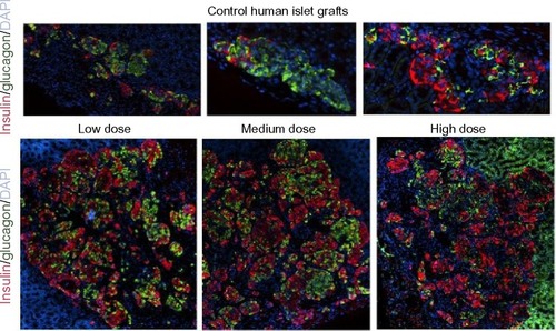 Figure 8 Photomicrographs of human islet grafts from control and lixisenatide-treated mice.