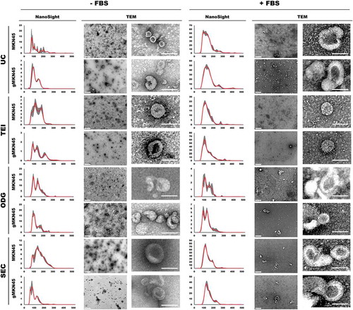 Figure 4. Characterization of extracellular vesicles isolated by differential ultracentrifugation (UC), total exosome isolation (TEI), OptiPrepTM density gradient (ODG) and size exclusion chromatography (SEC) methodologies using NTA analysis and transmission electron microscopy (TEM) imaging, including lower magnification (left) and zoomed in pictures (right). Extracellular vesicles were collected from MKN45 and glycoengineered MKN45 (gMKN45) cell lines cultured in the absence (-FBS) or presence (+FBS) of FBS in the cell culture medium. At least two independent experiments were conducted. NTA graphs display in y-axis: concentration (in 106 particles/mL) and in x-axis: size (nm). TEM images: Scale bar represents 400 nm (left TEM panel) and 100nm (right TEM panel), respectively.