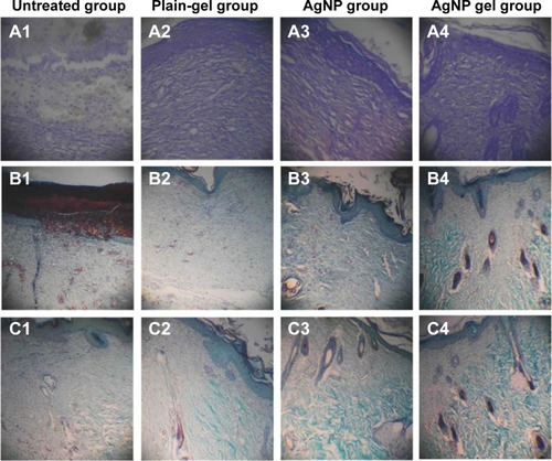 Figure 10 Histological examination of excision wounds in rat skin of different animal groups.Notes: (A1–A4) Wound bed stained with hematoxylin and eosin (magnification 100×). Wound bed (B1–B4) and edge (C1–C4) stained with Masson’s trichrome (magnification 40×).Abbreviation: AgNP, silver nanoparticle.