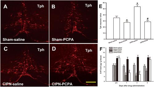 Figure 5 Inhibition of descending serotoninergic projection by RVM microinjection of PCPA. (A–E) Down-regulation of the RVM Tph expression by microinjection of PCPA. (A) Sham-saline group, (B) Sham-PCPA group, (C) CIPN-saline group, (D) CIPN-PCPA group. Bar: 200 μm. (E) Tph neurons count in RVM (n=3 per group, * vs Sham-saline group, P < 0.05, # vs CIPN-saline group, P < 0.05). (F) HPLC showing 5-HT content in the spinal dorsal horn at spinal levels L4–L6 was significantly lower in PCPA-treated rats compared with saline-treated rats in a time-dependent manner (n=3 per group, * vs Sham-saline group, P < 0.05, # vs CIPN-saline group, P < 0.05).