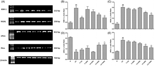 Figure 2. Effect of l-arginine on renal KIM-1, NGAL, eNOs, and iNOs mRNA expression in EG-induced urolithiasis in uninephrectomized rats (A), quantitative representation of mRNA expression of KIM-1 (B), NGAL (C), eNOs (D), and iNOs (E). Results are represented as mean ± SEM (n = 4) Data are analyzed by One-way ANOVA followed by post hoc Dunnett’s tests. ###p < 0.001 as compared with normal group. *p < 0.05, **p < 0.01 as compared with urolithiasis control group.
