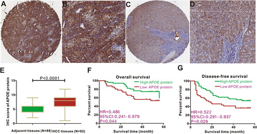 Figure 5. Expression and survival significance of APOE protein in HCC patients. Representative figures of APOE staining in HCC tissues (A-B) and adjacent liver tissues (C-D). APOE protein is highly expressed in HCC tissues (E). HCC patients with APOE over-expression displayed favorable overall survival (F) and disease-free survival (G) than those with low APOE expression.