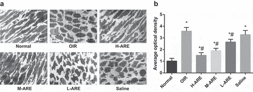 Figure 3. The ultrastructure of retina in OIR model mice was improved by Astragalus root extract. (a) Electron microscopic observation of retinal ultrastructure in neonatal mice in each group; (b) Fluorescence probe CellROX was used to detect the expression of reactive oxygen species in the retina of each group of mice; the data in the figure are all measurement data, by using the mean ± standard deviation form, one-way ANOVA was used for multiple groups comparison, and LSD-t-test was used for the pairwise comparison after ANOVA analysis. * P < 0.05 vs. the normal group; # P < 0.05 vs. the OIR group, N = 10