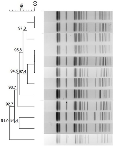 Figure 1 Dendrogram of PFGE profiles of 12 blaNDM-5-positive Klebsiella pneumoniae isolates.