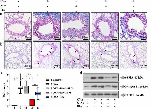 Figure 5. Rhy-SLNs ameliorated the OVA-induced airway remodeling of murine experimental asthma. Mice were subcutaneously injected with 20 μg OVA mixed with 1 mg aluminum hydroxide on days 0, 14, 28, and 42 and administrated aerosolized 1% OVA (w/v) by inhalation from day 21 to day 42. Mice were intraperitoneally injected with 20 mg/kg Rhy-SLNs or 20 mg/kg Rhy at one hour before the airway challenge with OVA. a, the representative images of Masson-stained airway in lung tissues. b and c, the representative images of periodic acid-Schiff-stained goblet cells of airway in lung tissues, which were quantified with the mucus score. Black arrows represented the goblet cells. d, the protein levels of α-SMA and collagen I. n = 6 in each group. *p < 0.05, **p < 0.01. OVA, ovalbumin; Rhy, rhynchophylline; Rhy-SLNs, rhynchophylline-solid lipid nanoparticles; α-SMA, alpha-smooth muscle actin