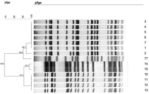 Figure 1 Dendrogram of patterns for carbapenem-resistant K. pneumonia isolates obtained by PFGE.
