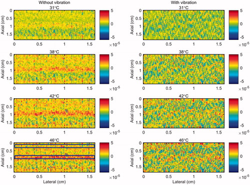 Figure 6. 2 D gradient maps in tissue mimicking gel phantom obtained using the conventional echo-shift technique without (left) and with (right) presence of vibration in the phantom. The temperatures measured by the inserted thermocouple were 31, 38, 42 and 46 °C at the center of heated region. The color bars represent the axial gradient of the cumulative time shifts in units of s/m. The horizontal rectangles are the regions of interest for calculating the CNR and SNR.
