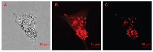 Figure 9 Images of a single HeLa cell treated with ND-transferrin complex: (A) bright-field image, (B) confocal scanning image obtained by collecting all the fluorescence emissions above a wavelength of 550 nm, and (C) confocal scanning image obtained by collecting only the fluorescence emissions at wavelengths of 663–738 nm.Note: A 514.5 nm laser was used as excitation source.Reprinted from: Weng MF, Chiang SY, Wang NS, Niu H. Fluorescent nanodiamonds for specifically targeted bioimaging: application to the interaction of transferrin with transferrin receptor. Diam Relat Mater. 2009;18(2–3):587–591.Citation126 Copyright (2008), with permission from Elsevier.Abbreviation: ND, nanodiamonds.