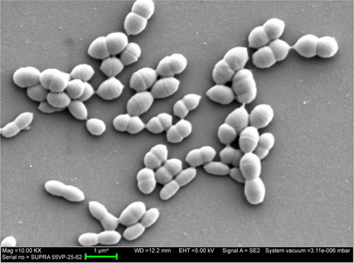 Figure S1 SEM images of Streptococcus gordonii biofilms for 24 hours on untreated Ti surface.Abbreviations: SEM, scanning electron microscopy; Mag, magnification.