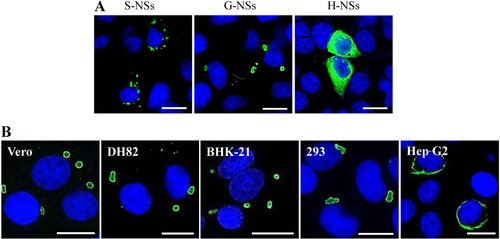 Fig. 5 Immunofluorescence assay to characterize the NSs-induced IB formation in cells.a The NSs distribution in cells was observed by IFA in 293 cells transfected with NSs expression plasmids. G-NSs, GTV NSs; S-NSs, SFTSV NSs; and H-NSs, HRTV NSs. b GTV NSs-induced IB formation was observed in cell lines from different hosts. NSs expression in cells was detected by IFA. Bars, 15 μm