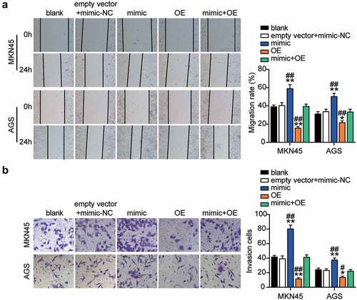 Figure 7. MiR-130a-3p targeting GCNT4 enhanced cell migration and invasion of gastric cancer cells