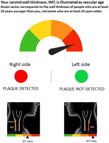 Figure 1. Graphical elements of the result letter, sent to participants in the intervention group after the ultrasound examination of carotid arteries, including information on plaque and intima media thickness.