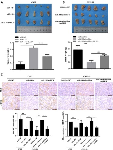 Figure 5 Mir-181a promotes NPC radioresistance by inhibiting RKIP in vivo.Notes: The mice bearing xenografts were treated by 6Gy irradiation, and the tumors were resected and photographed. In line with the results in vitro, demonstrated by weight of xenografts, miR-181a overexpression enhanced the irradiation tolerance of CNE2 cells, and ectopic expression of RKIP re-sensitized CNE2 cells to irradiation (0.074±0.04 vs 0.322±0.03 vs 0.192±0.03) (A); similarly, miR-181a inhibitor overexpression sensitized CNE2-IR cells to irradiation, and RKIP knockdown re-reinforced the tolerance of CNE2-IR cells to irradiation (0.572±0.12 vs 0.186±0.06 vs 0.392±0.03) (B). (C) As the IHC staining of RKIP showed, the expression of RKIP pattern in xenografts was consistent with expression pattern in its corresponding NPC cells(4.4±1.02 vs 1.8±0.75 vs 4±0.63; 1.6±0.8 vs 4.2±0.75 vs 1.8±0.0.75). As the staining of γH2AX indicated, miR-181a overexpression alleviated the degree of DNA damage, which could be antagonized by ectopic expression of RKIP, in CNE2 cells (40±7.07 vs 24±3.74 vs 36.2±6.33); accordingly, miR-181a inhibitor upregulation enhanced the degree of DNA damage which could be counteracted by RKIP knockdown, in CNE2-IR cells (24.8±3.19 vs 41.6±6.95 vs 24±3.74). **Stands for P <0.01, ***Stands for P <0.001.