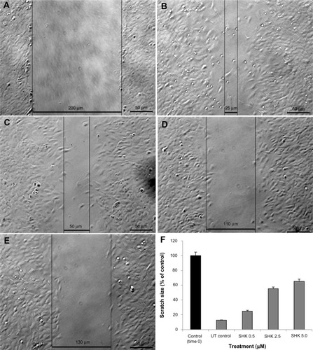 Figure 7 Effect of SHK on migration of ovarian cancer OVCAR-5 cells.Notes: Cells were scratched and imaged at time 0 (A) and 6 hours post-scratching (B–E). (B) Untreated control cells. (C) Cells treated with 0.5 μM SHK. (D) Cells treated with 2.5 μM SHK. (E) Cells treated with 5.0 μM SHK. (F) Cell migration analysis of treated cells in comparison with the scratched cells at time 0.Abbreviations: SHK, shikonin; UT, untreated.