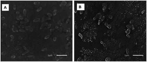 Figure 9. Scanning electron micrograph of P. aeruginosa isolates: A) before and B) after treatment with ZnO-NPs. 