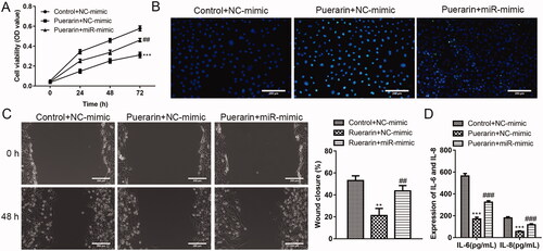 Figure 5. Overexpression of miR-29b-3p weakens the inhibition effect of puerarin on ox-LDL-induced hVSMC. (A) Cell viability of ox-LDL-induced hVSMC cells in the control + NC mimics group, puerarin + NC mimics group and puerarin + miR-29b-3p mimics group was detected at 24 h, 48 h, and 72 h. (B) Cell apoptosis of ox-LDL-induced hVSMC in the three groups was detected by TUNEL staining. (C) The cell migration ability of ox-LDL-induced hVSMC cells in the three groups was assessed by wound healing assay. Scale bar = 100 μm. (D) Expression of pro-inflammatory factors IL-6 and IL-8 of ox-LDL-induced hVSMC cells in the three groups. ##P < 0.01, ###P < 0.001, ***P < 0.001.